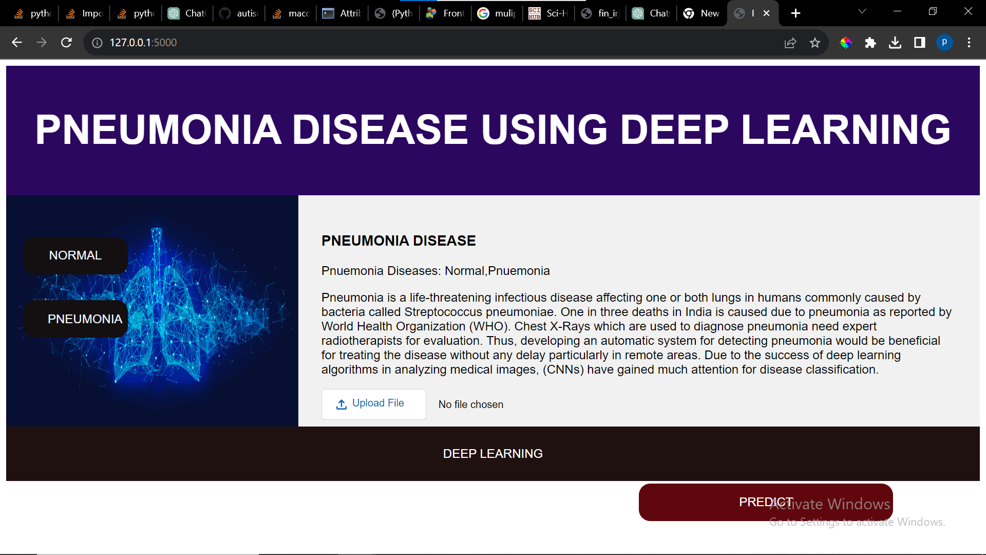 Pneumonia Detection Using X-Ray Images Image Processing Using Deep Learning